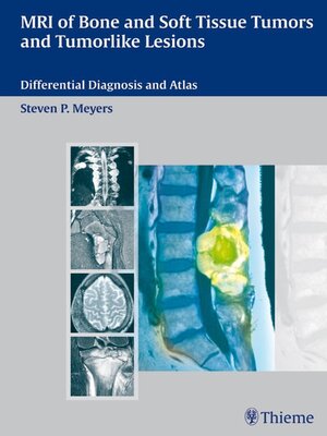 cover image of MRI of Bone and Soft Tissue Tumors and Tumorlike Lesions